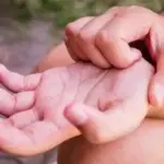 Свербіж долонь